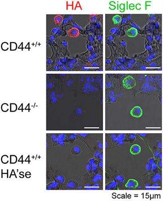 Hyaluronan and Its Interactions With Immune Cells in the Healthy and Inflamed Lung